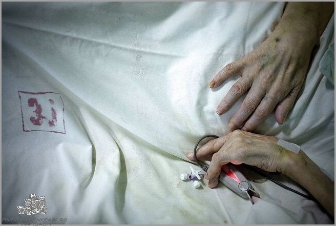 Jak Wygląda Człowiek Odwodniony? Zobacz! Jak Wygląda Człowiek Odwodniony? Zobacz!